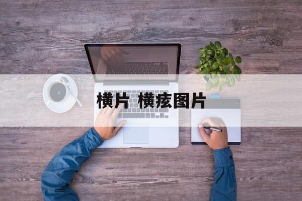 横片 横痃图片-第1张图片-